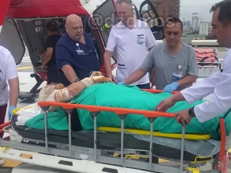 Весь в бинтах, обожженное лицо. В РФ показали "военкора" Поддубного, в чью машину влетел FPV. Видео